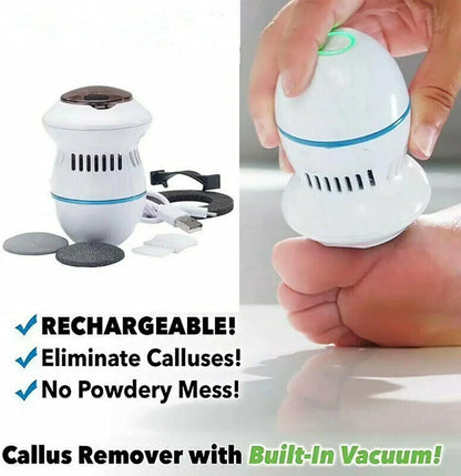 Electric Callus Remover - 50% OFF
